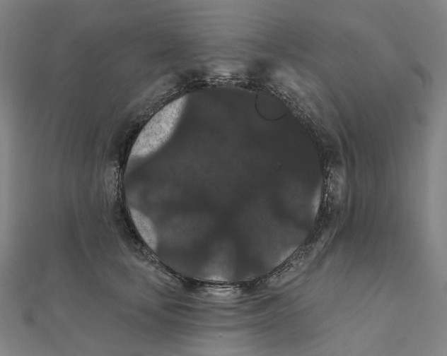 X0000111420659200908101057