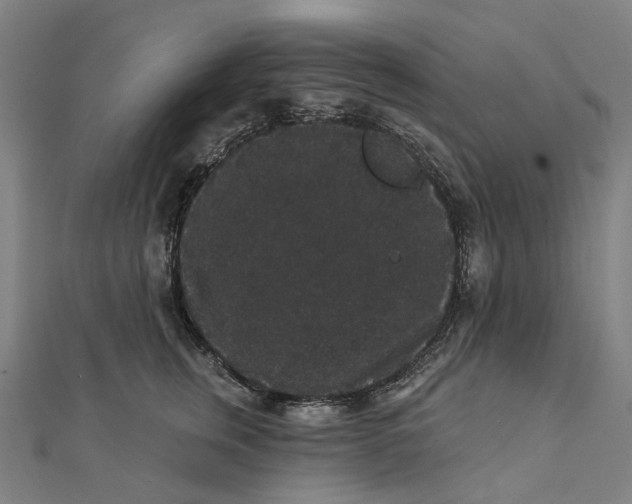 X0000111420759200908101055