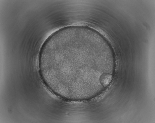 X0000111420838200908101054