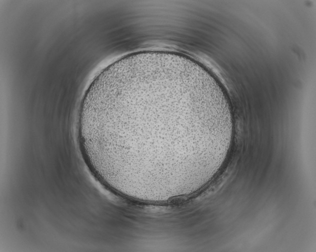 X0000111421379200908101047