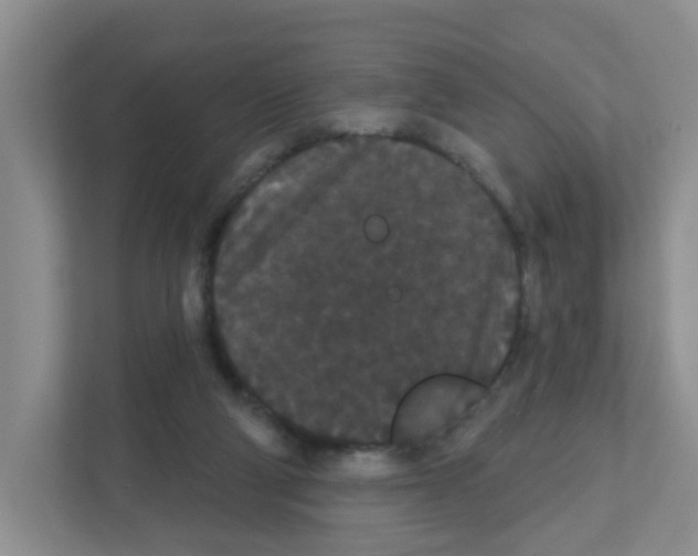 X0000111420114200908241140