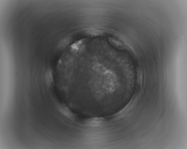 X0000111420128200908241139