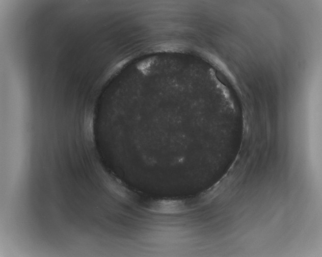X0000111420154200908241139