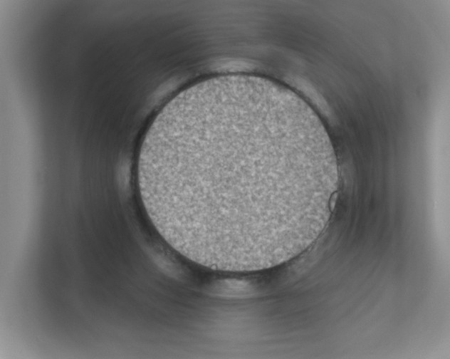 X0000111420159200908241139