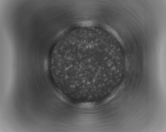 X0000111420161200908241139