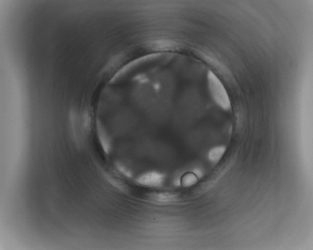 X0000111420165200908241139