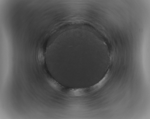 X0000111420186200908241139