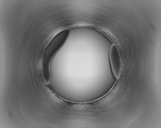 X0000111431185200907131034