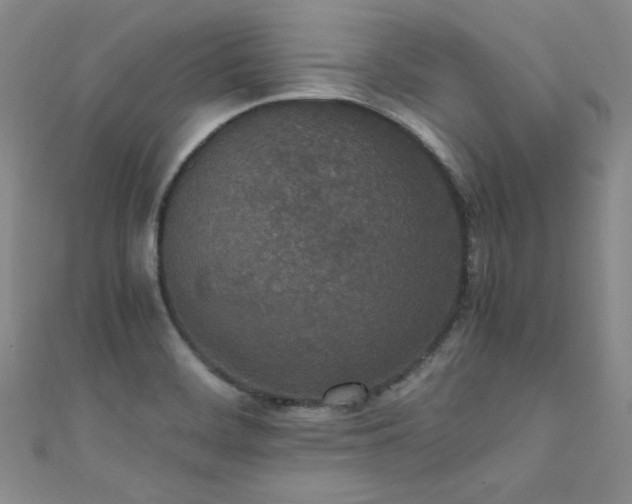 X0000111431468200907131213