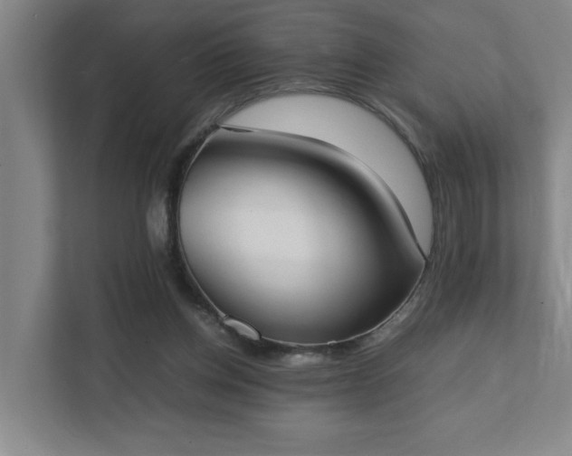 X0000111430158200907201115