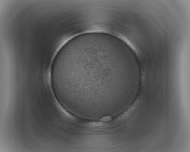 X0000111431468200907201058