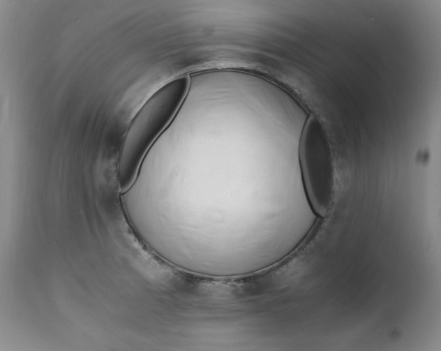 X0000111431185200907271058