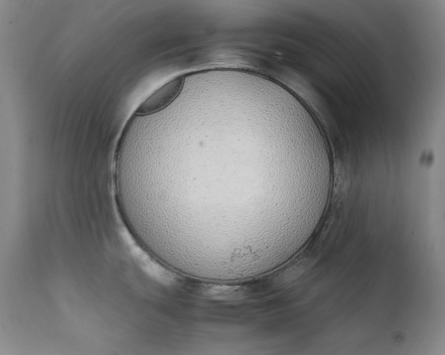 X0000111431439200907271055