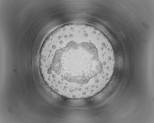 X0000111430856200908241120