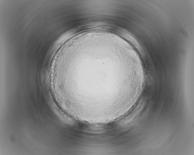 X0000111431338200908241113