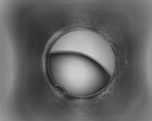 X0000111440197200907131027