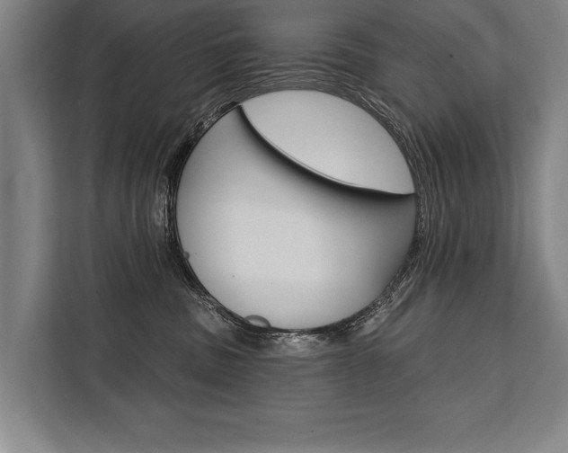 X0000111440379200907131025