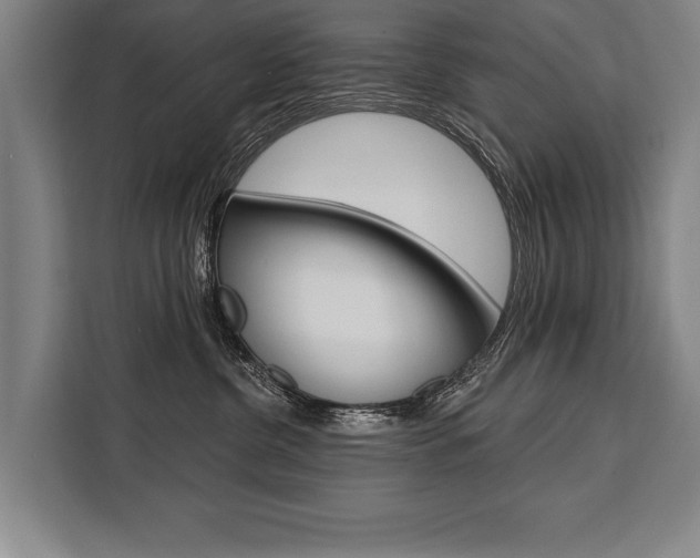 X0000111440380200907131025