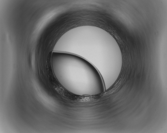 X0000111440382200907131025