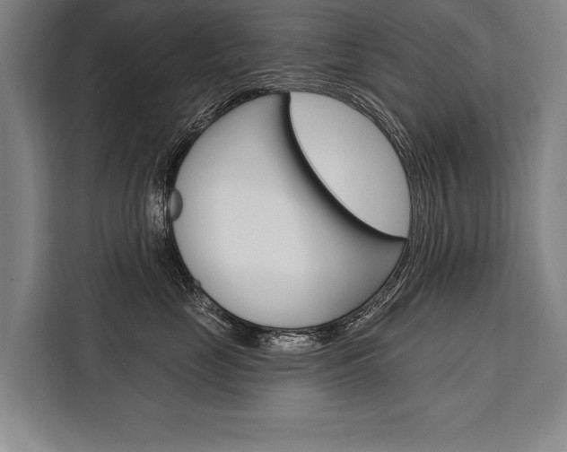 X0000111440669200907131022