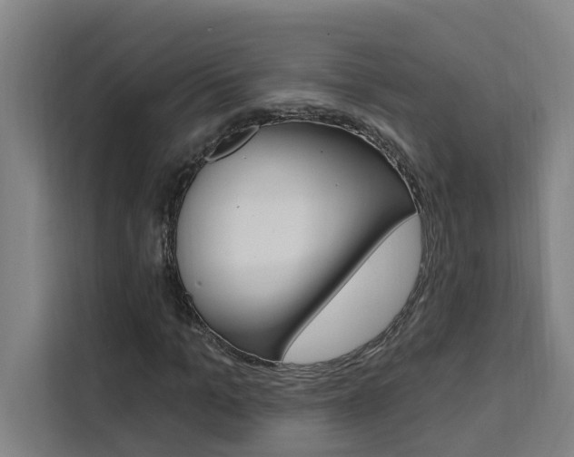 X0000111440965200907131017
