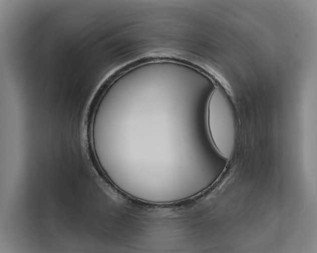 X0000111440976200907131017