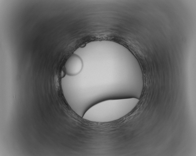 X0000111441106200907131015