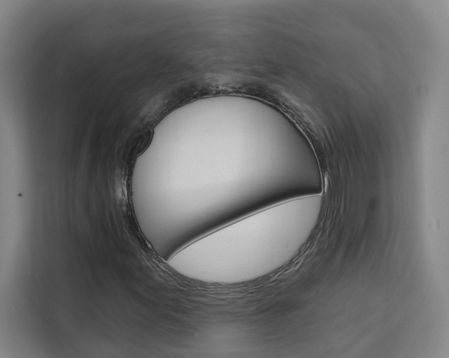 X0000111441155200907131015