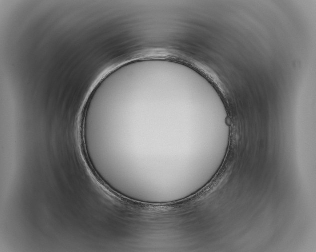 X0000111441475200907131011