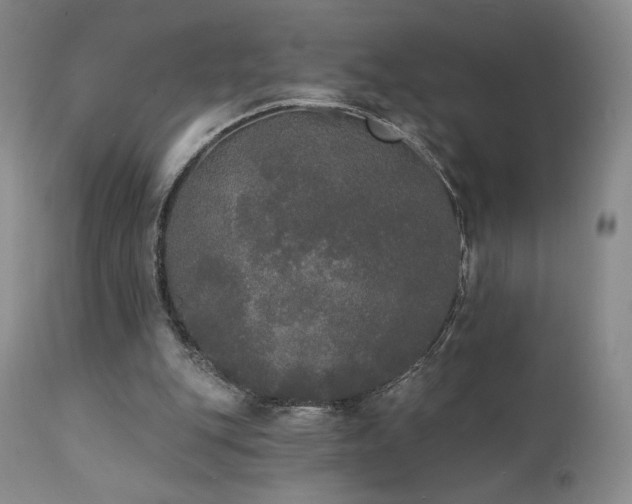 X0000111440151200907131314