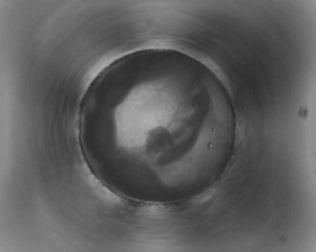 X0000111440950200907131302