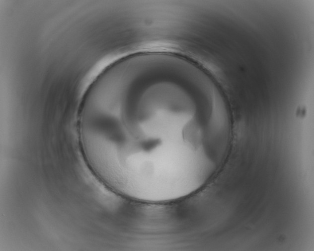 X0000111441470200907131253