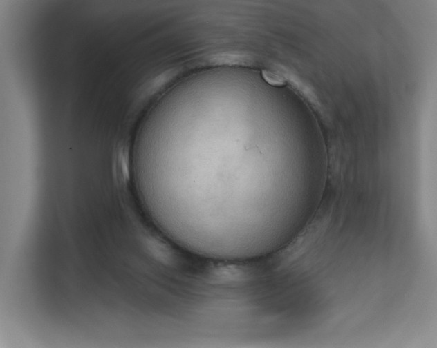 X0000111440062200907201137