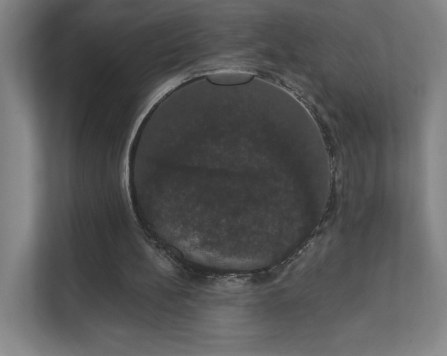 X0000111440148200907201135