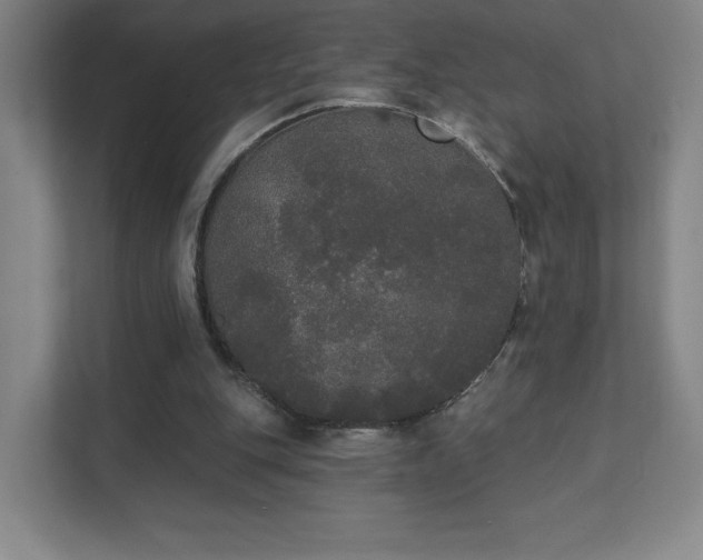 X0000111440151200907201135