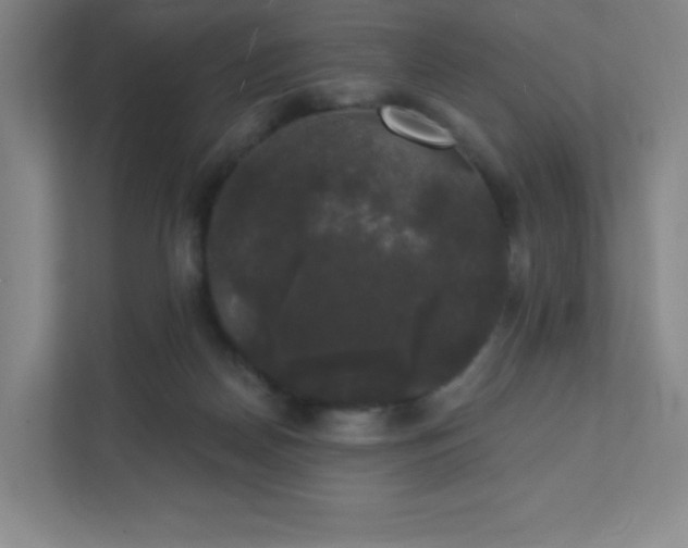 X0000111440170200907201136