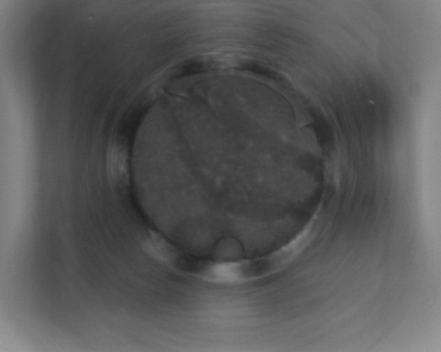 X0000111440178200907201136