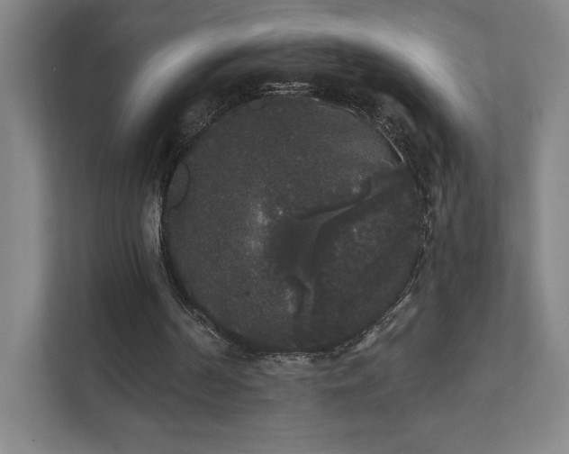 X0000111440194200907201135