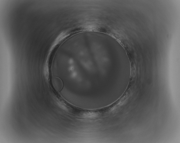 X0000111440198200907201135