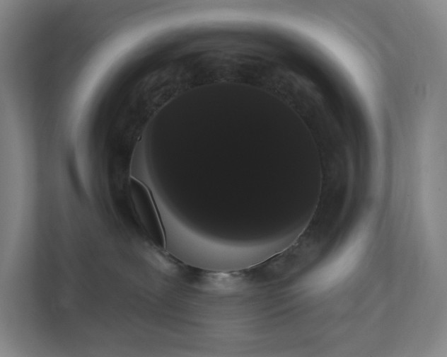 X0000111440239200907201135