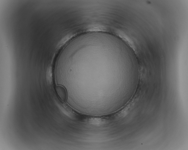 X0000111440298200907201134