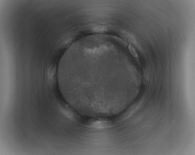 X0000111440364200907201133