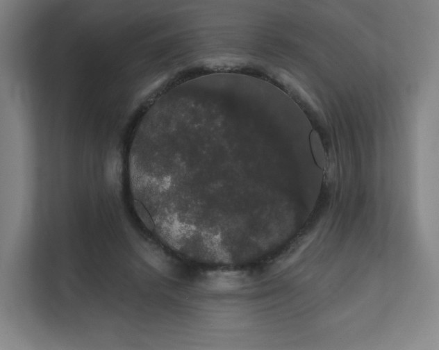 X0000111440448200907201132