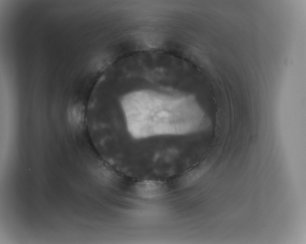 X0000111440672200907201130