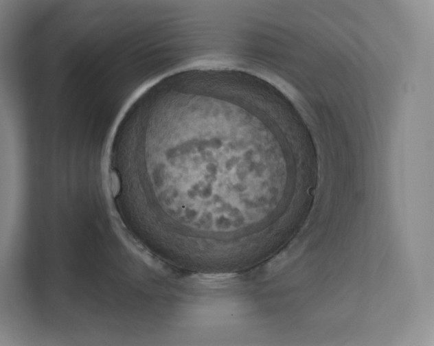 X0000111440864200907201127