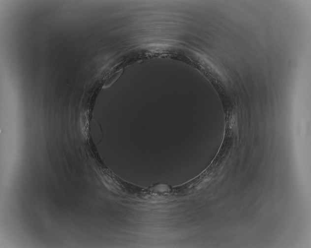 X0000111440868200907201127