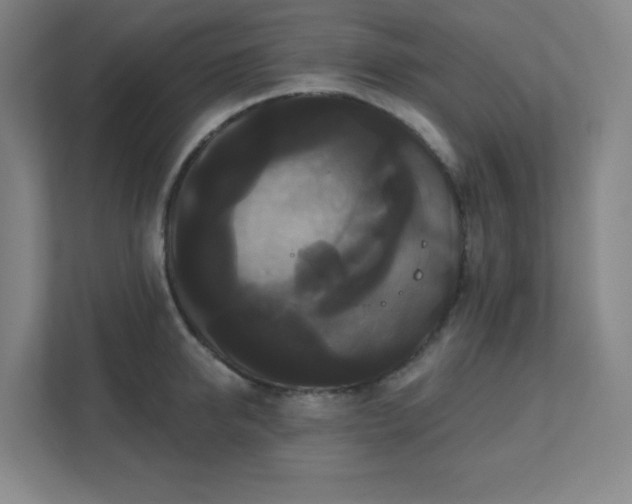 X0000111440950200907201126