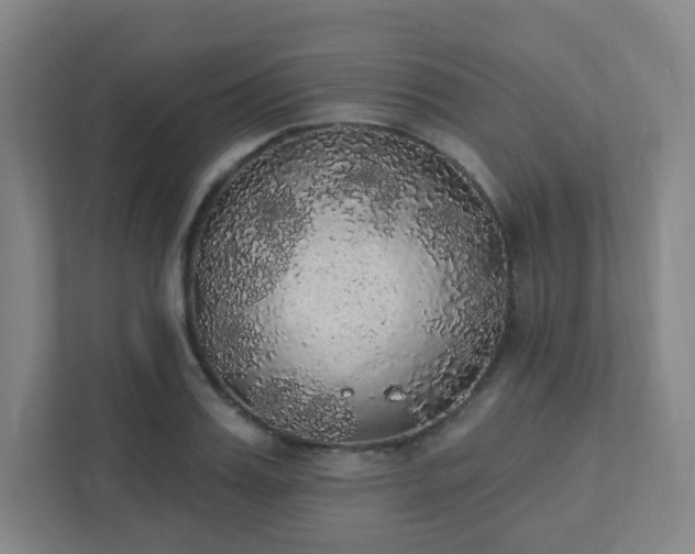 X0000111440987200907201125