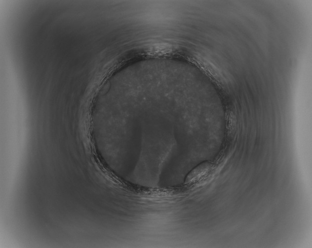 X0000111441153200907201123