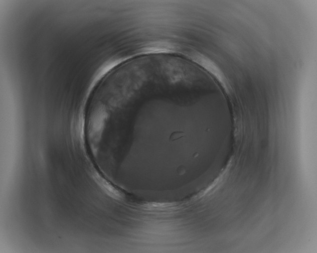X0000111441179200907201122